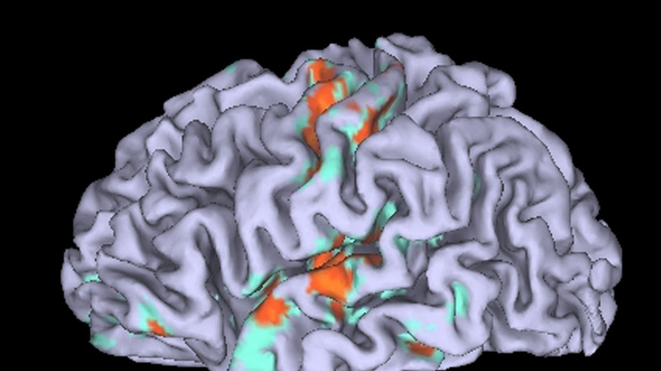 Riscritta la storia dell'evoluzione del cervello