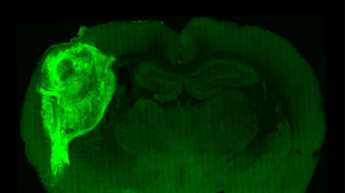 Implantan células del cerebro humano en ratas para estudiar desórdenes psiquiátricos