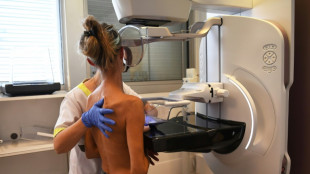 Cancer du sein: le Sénat unanime pour améliorer la prise en charge des soins