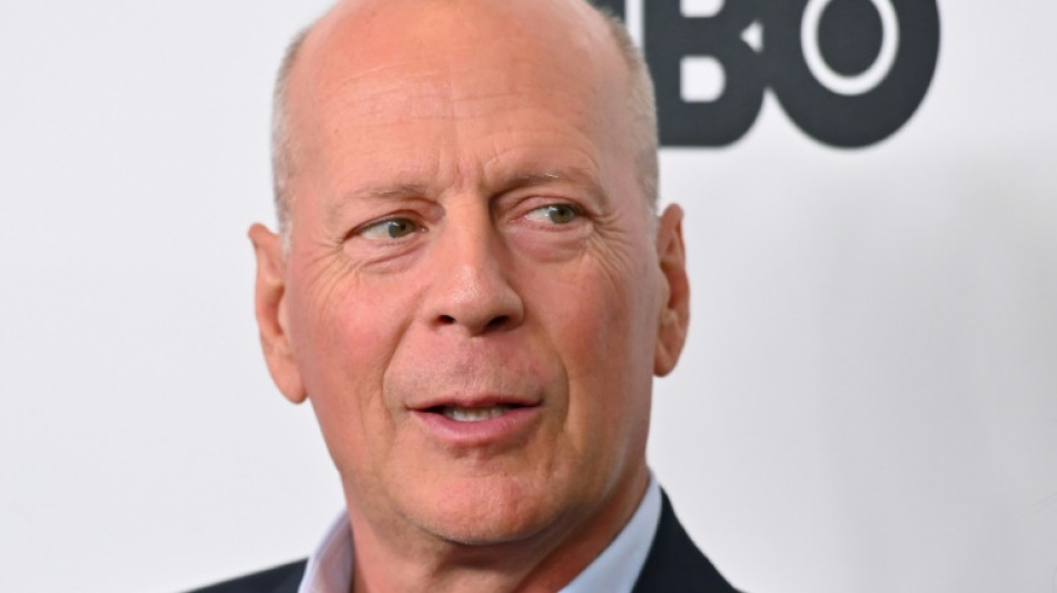 L'acteur Bruce Willis souffre d'aphasie et met fin à sa carrière (famille)